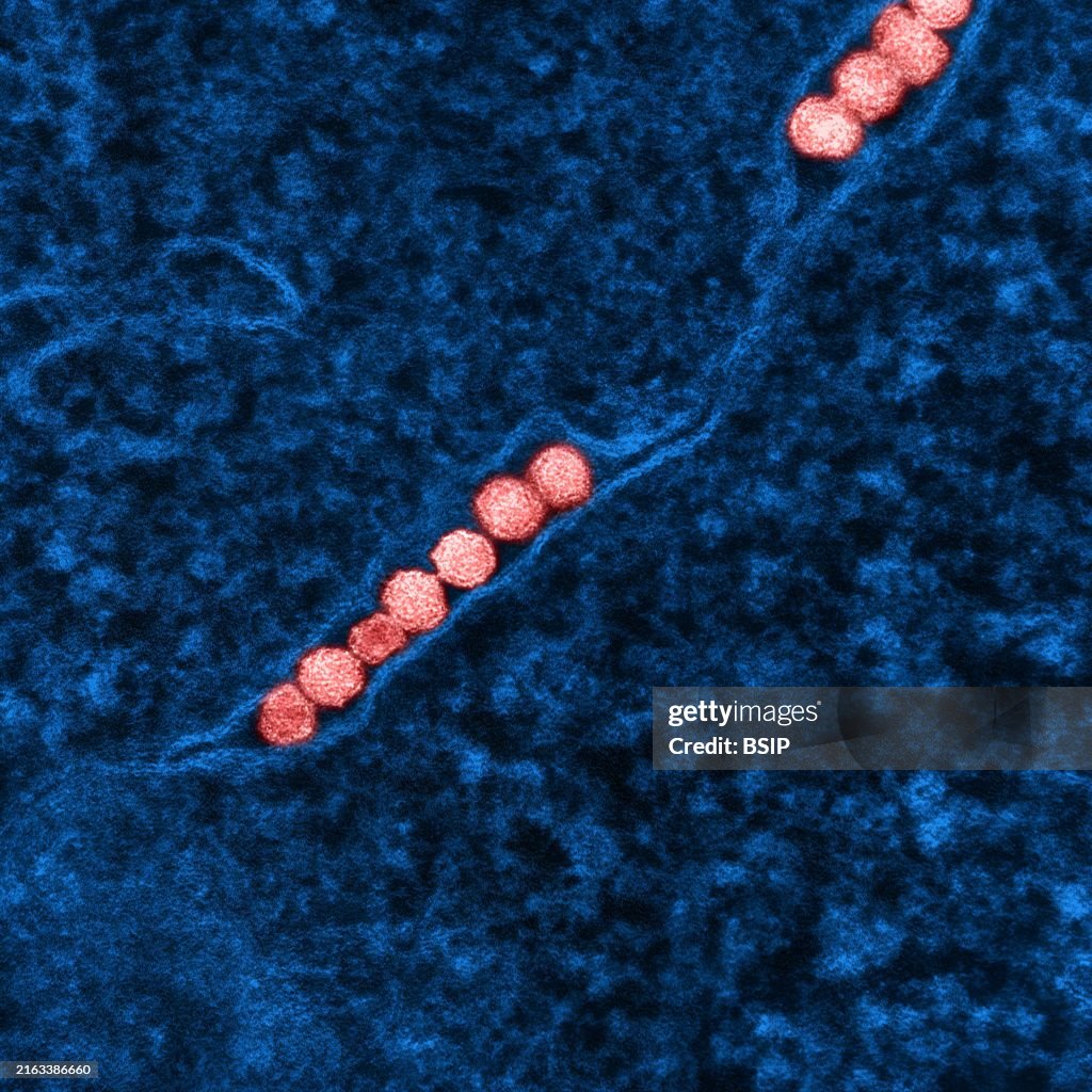 West nile virus