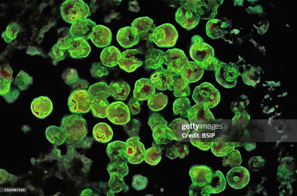 Naegleria fowleri