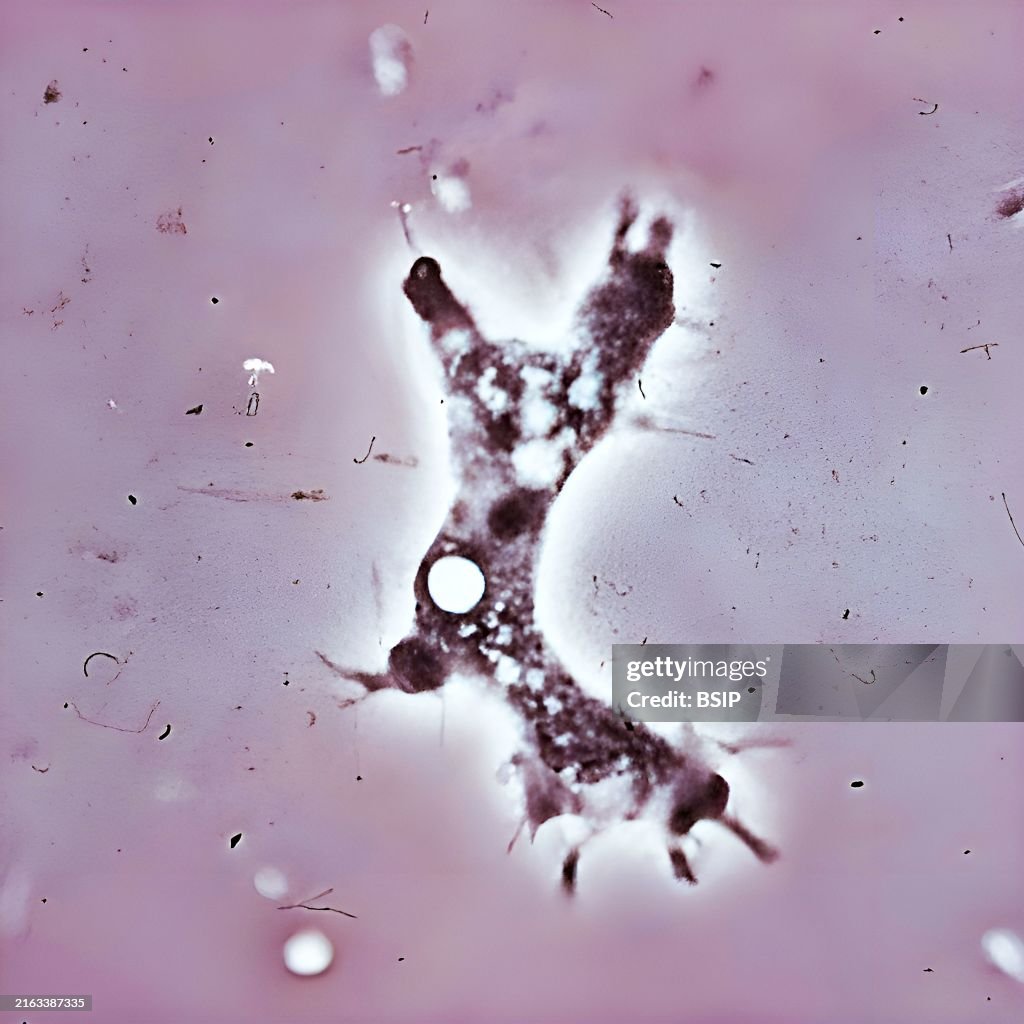 Acanthamoeba