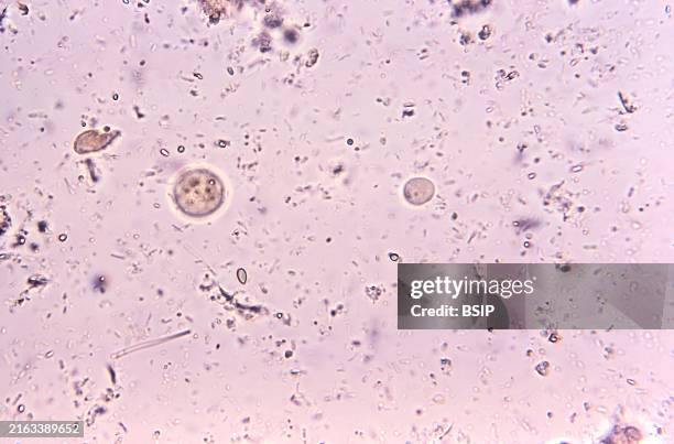 Under 500X magnification, this photomicrograph of an unstained direct mount specimen revealed the presence of a cyst of the protozoan parasite,...
