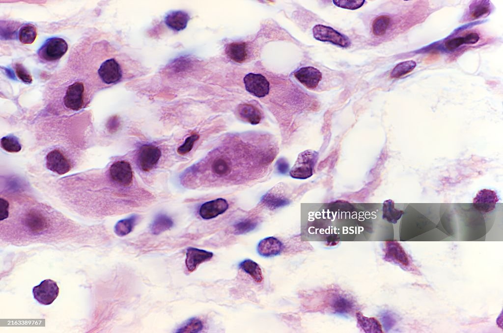 Acanthamoeba sp