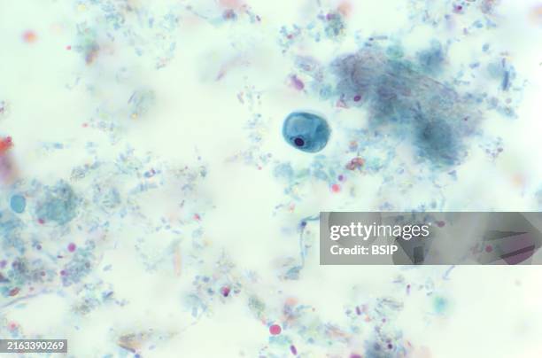 This photomicrograph of a trichrome-stained specimen revealed a single Iodamoeba butschlii parasitic cyst, in which a large achromatic glycogen...