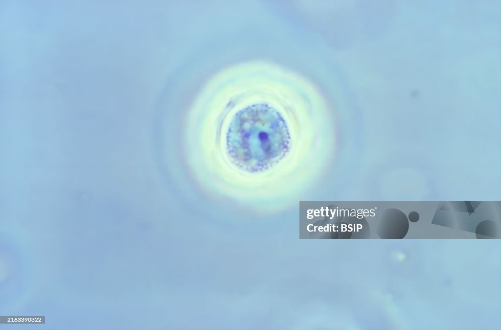 Acanthamoeba polyphaga