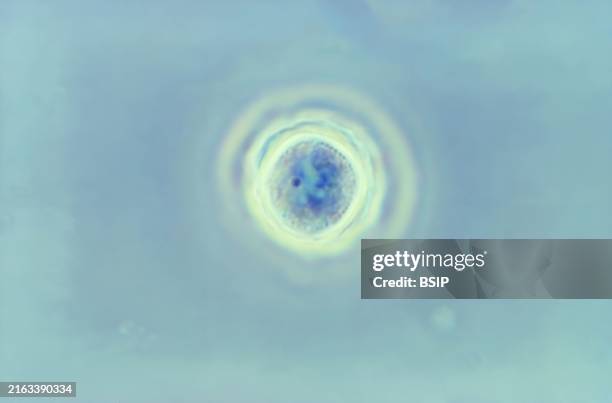 Using phase contrast imaging and magnified 1125X, this photomicrograph depicts a cyst of the protozoan Acanthamoeba polyphaga. CDC/Dr George Healy...