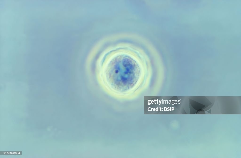 Acanthamoeba polyphaga