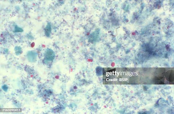 This photomicrograph of a trichrome-stained specimen revealed the presence of an Entamoeba hartmanni trophozoite . E. Hartmanni is classified as a...