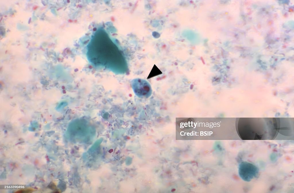 Entamoeba hartmanni