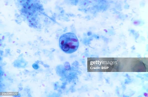Microplane Microscope 130 Micro Plane Stock Photos, High-Res Pictures, and Images - Getty Images