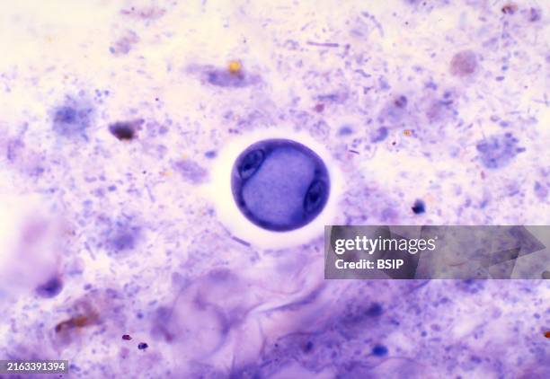 This photomicrograph shows a number of cysts of the amoebic parasite Iodamoeba butschlii . Note the large, lightly colored glycogen vacuole contained...
