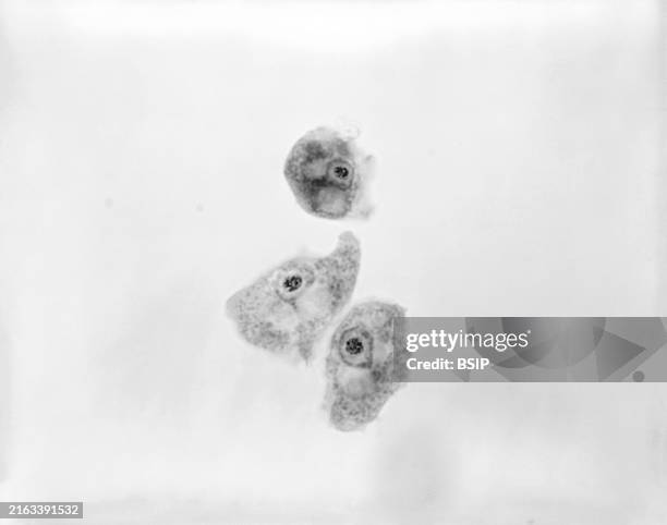 This 1973 photomicrograph depicts three Naegleria gruberi, free-living amoebae. CDC/Dr George Healy 1973.