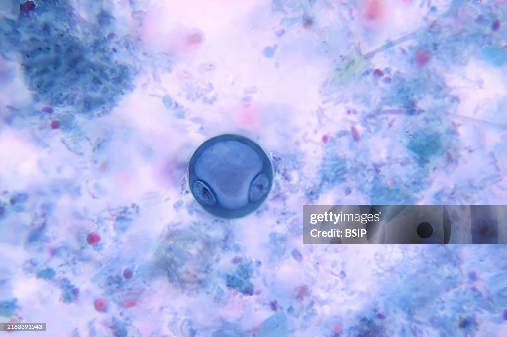 Entamoeba coli