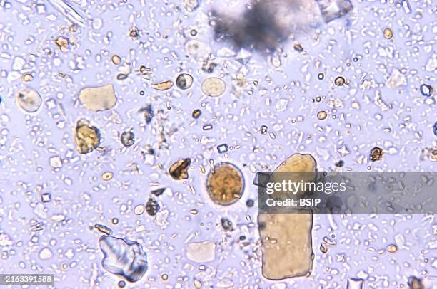 Under 500X magnification, this photomicrograph of a concentrated, iodine-stained direct mount specimen revealed the presence of a protozoan parasite...