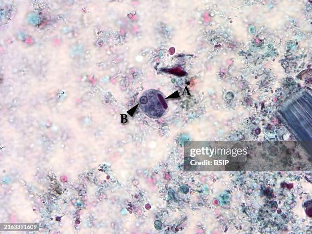 Using trichrome staining, this photomicrograph depicts a cyst of the single-celled parasite, Entamoeba histolytica. Colored blue, the cyst, seen here...