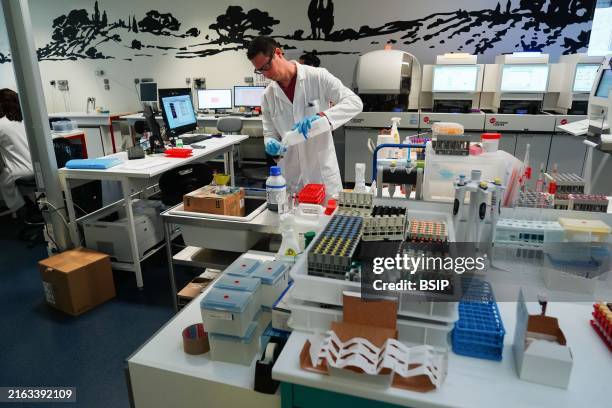 Technical platform of the Inovie 34 laboratory. Staining of a malaria slide and diagnostic smear to rule out malaria in a patient. After reaction,...