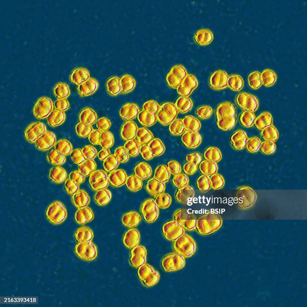 Meningococcus or meningococcal disease or Neisseria meningitidis, is a bacteria involved in meningitis. These bacteria are the cause of mild...