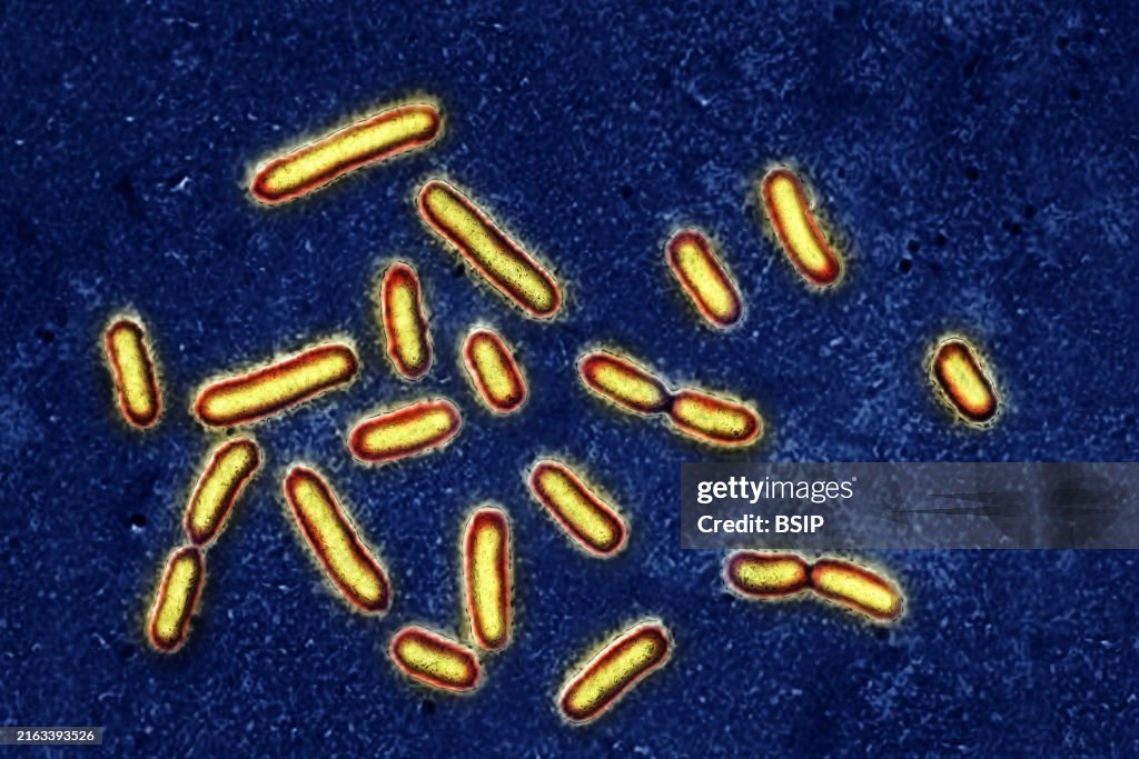 Pseudomonas aeruginosa