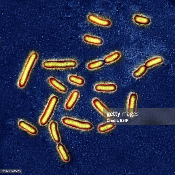 Pseudomonas aeruginosa or pyocyanin bacillus, pathogenic bacteria, very resistant and often responsible for nosocomial infections. It is one of the...
