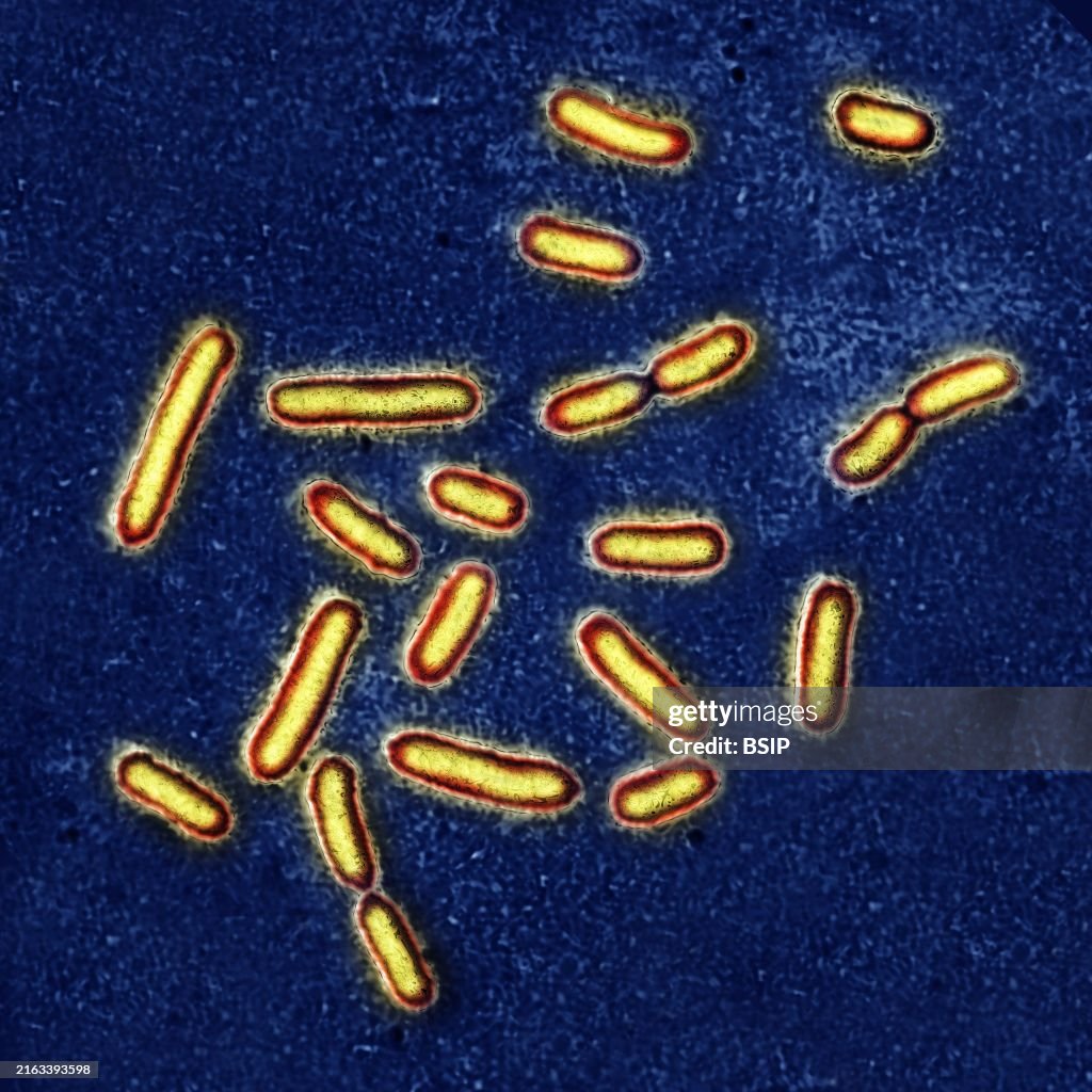 Pseudomonas aeruginosa