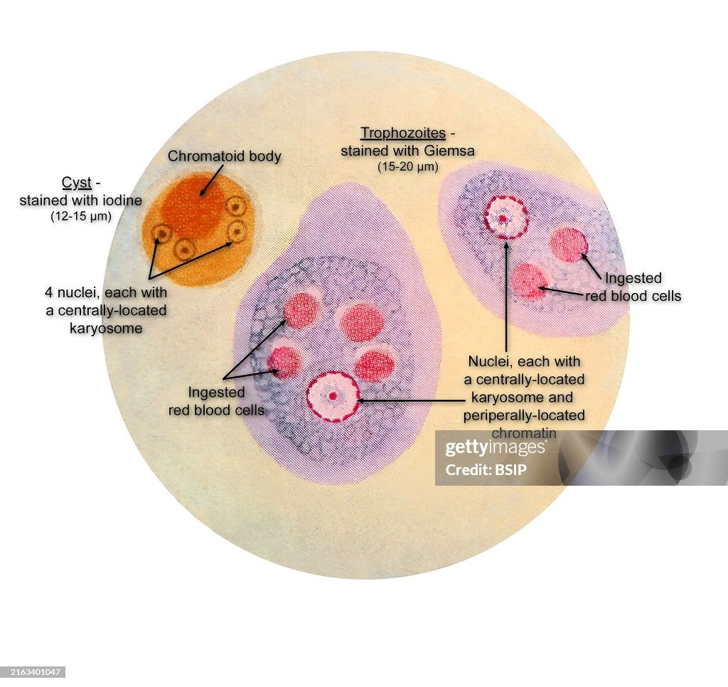 Entamoeba histolytica