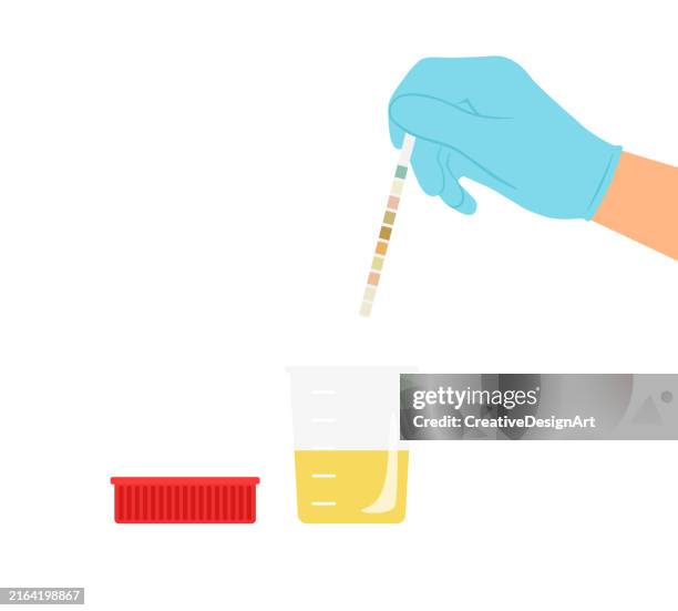 arzt gibt medizinische handschuhe mit urinteststreifen zur diagnose von harnwegsinfektionen ab. urintestprobe im behälter auf weißem hintergrund. urin-analyse - drogentest stock-grafiken, -clipart, -cartoons und -symbole