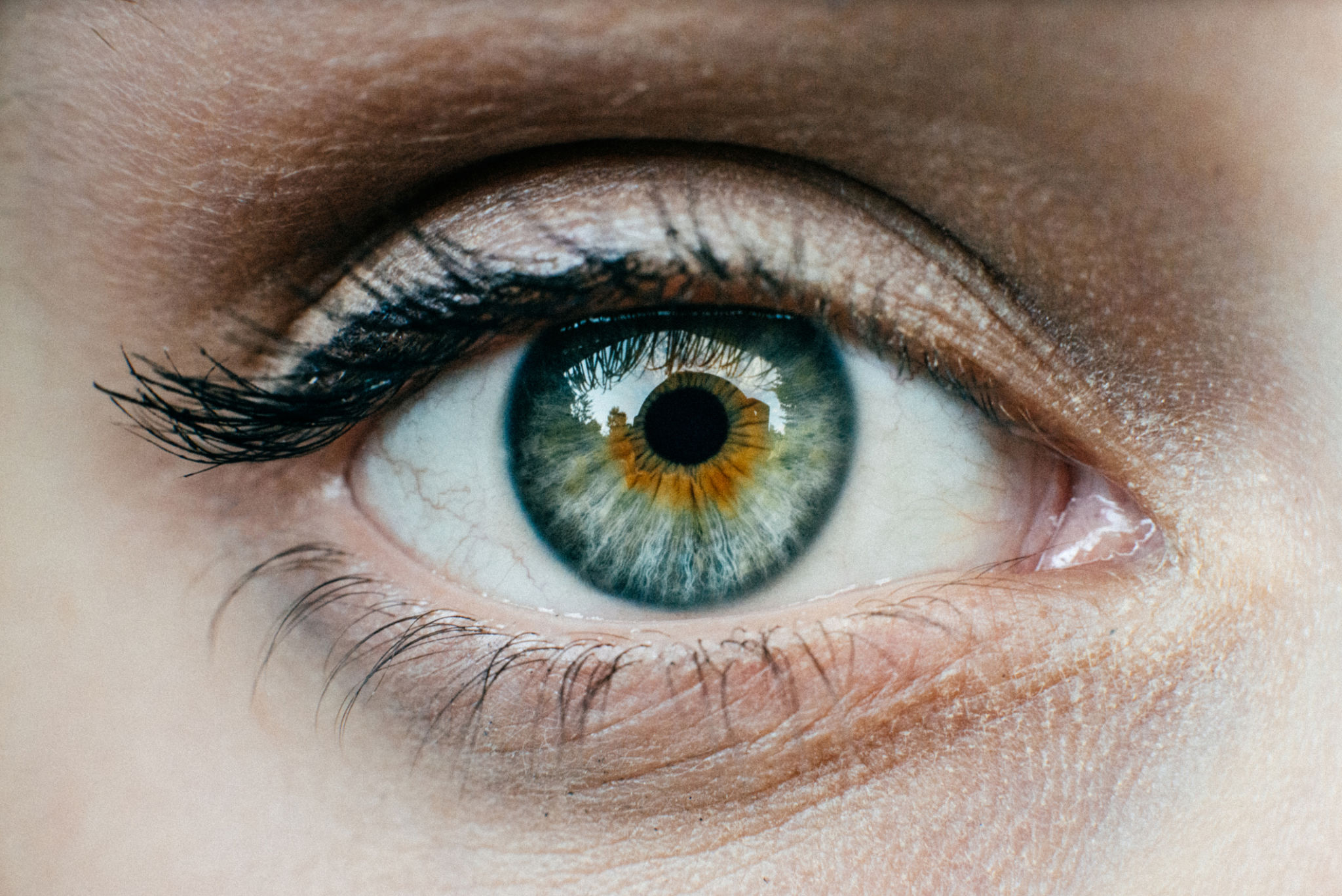 iris eye