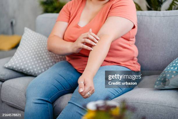 young woman scratching her skin at home - mosquito bite stock pictures, royalty-free photos & images