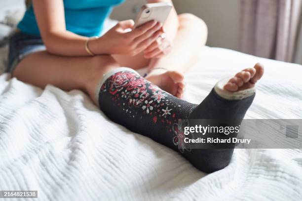 a teenage girl with her leg in a cast - gipsbein stock-fotos und bilder