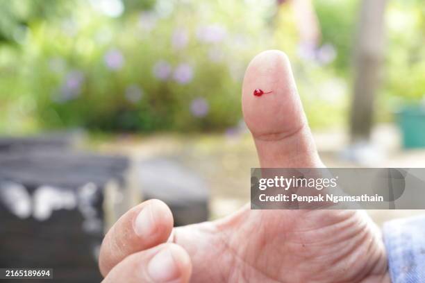 knife wound on the thumb bleeding - schnittwunde stock-fotos und bilder