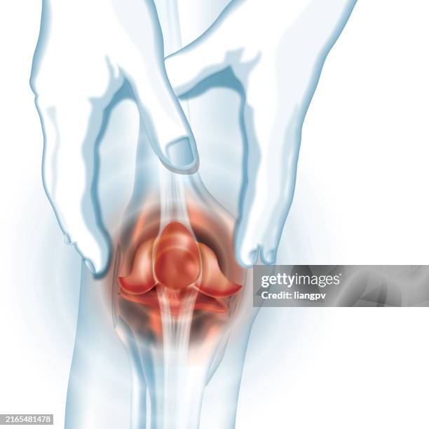 knie schmerzen - menschlicher muskel stock-grafiken, -clipart, -cartoons und -symbole