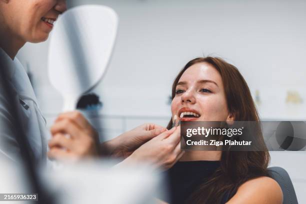 patient getting dental veneer fitted - higiene dental imagens e fotografias de stock
