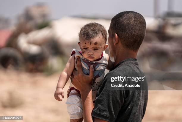 Three-month-old baby Rim is the sole survivor after an Israeli military attack on the home of the Abu Hiyye family in Khan Yunis, Gaza on August 15,...