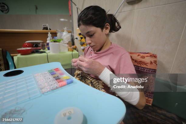 The sisters Dima and Rima , who suffered 3rd degree burns and many fractures on their bodies due to the attack, are still being treated at Al-Aqsa...