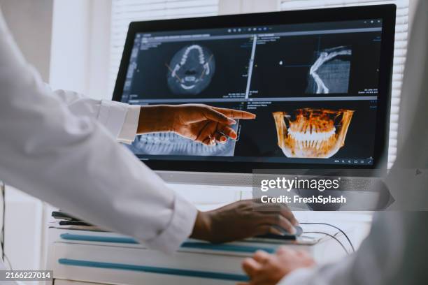 dentistas que analisam imagens de raio x de digitas no ecrã do computador - ultrasonografia médica instrumento para diagnóstico - fotografias e filmes do acervo