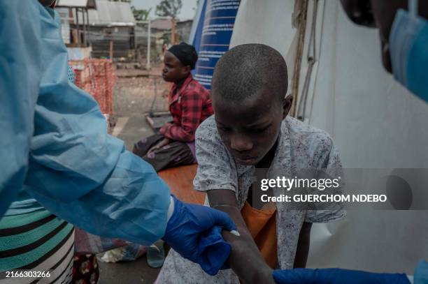 1.586 Mpox Fotos und hochauflösende Bilder - Getty Images 1.586 Mpox Fotos und hochauflösende Bilder - Getty Images
