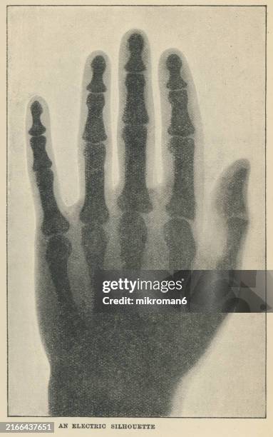 old engraved illustration of early x-ray photographs, human hand - sketch stock pictures, royalty-free photos & images
