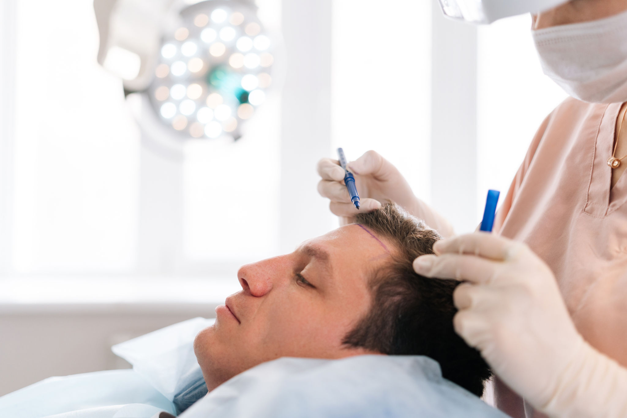 hair transplant surgery