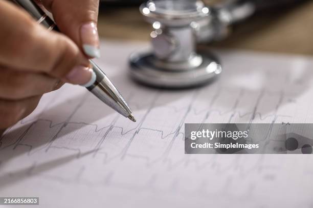 a close-up view of the ekg chart on which the arrhythmia is visible and the doctor examines its progress. - echokardiogramm stock-fotos und bilder