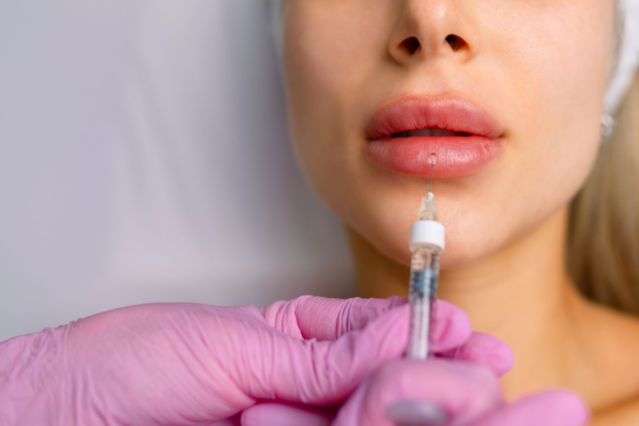 dermal fillers