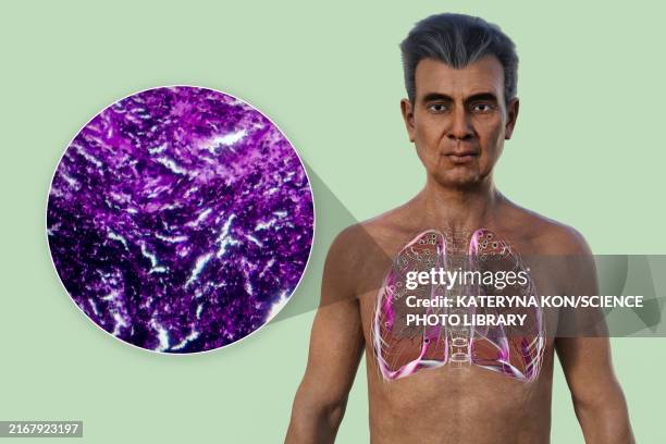 71,770 Human Body Without Skin High Res Illustrations - Getty Images