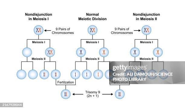trisomy 9 syndrome, illustration - karyotype stock illustrations