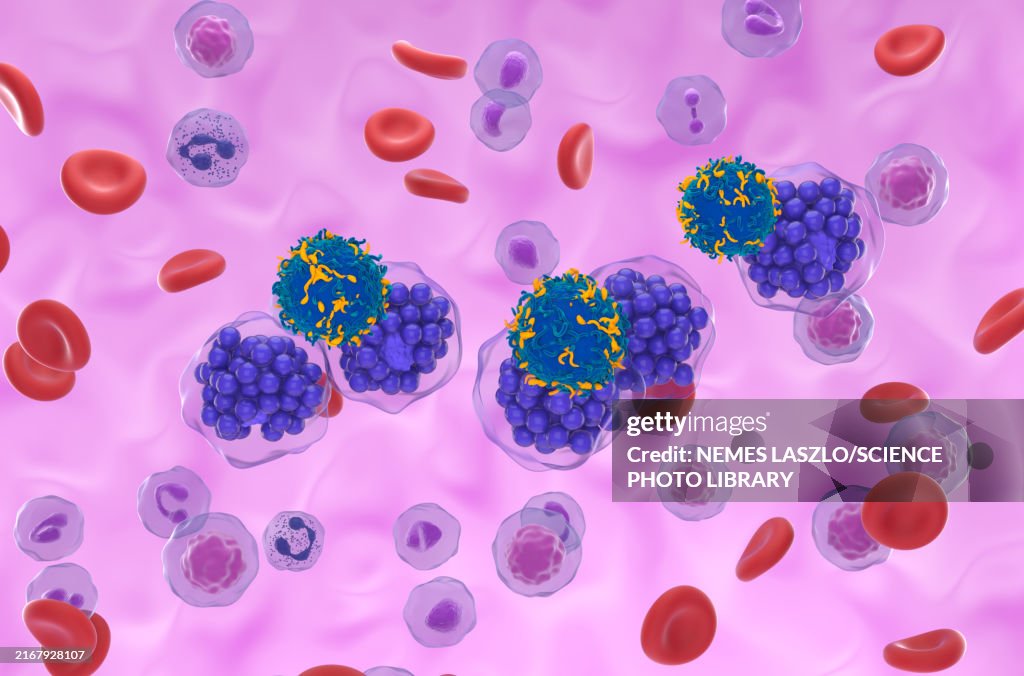 CAR-T cell therapy for diffuse large B-cell lymphoma, illustration