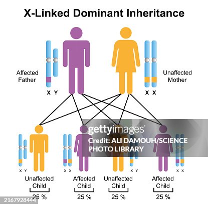 X-linked dominant inheritance, illustration X-linked dominant inheritance, illustration
