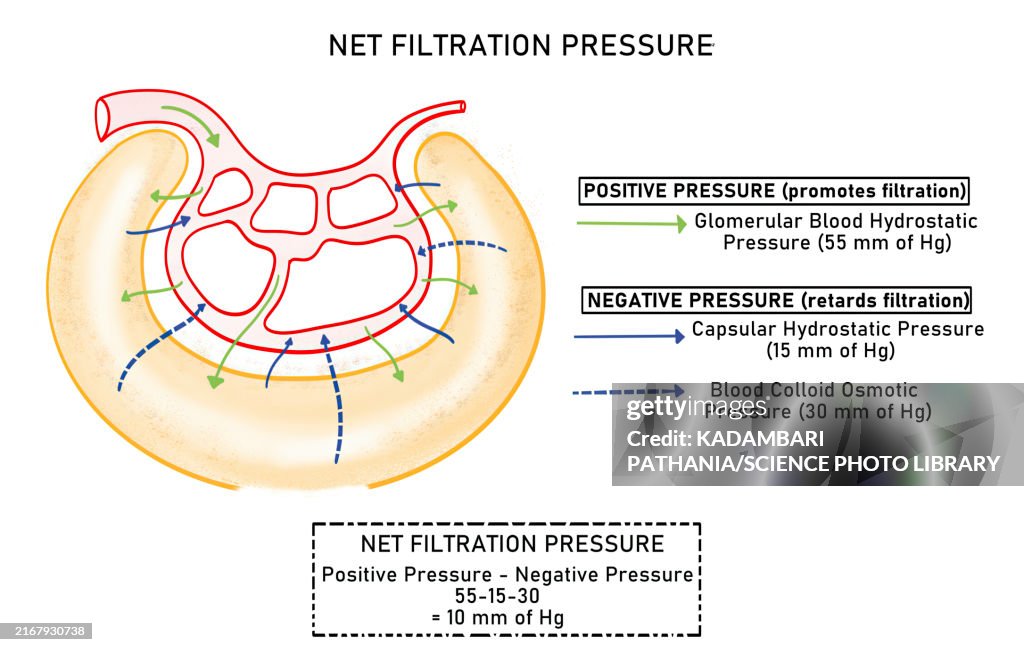 Net filtration pressure during ultrafiltration, illustration