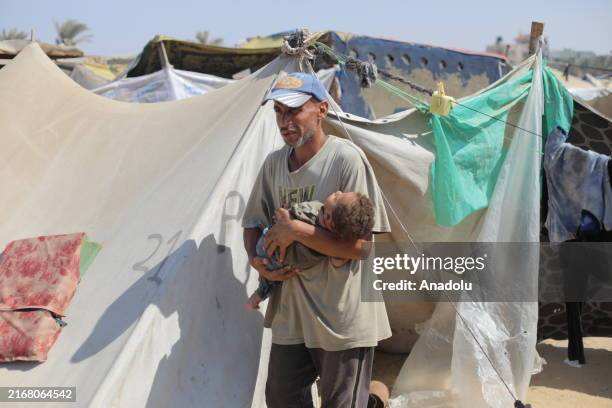The 11-month-old Abdul Rahman Abu al-Jidyen, who is suffering from polio, is out of a tent with his father in Deir Al Balah, Gaza on August 27, 2024....