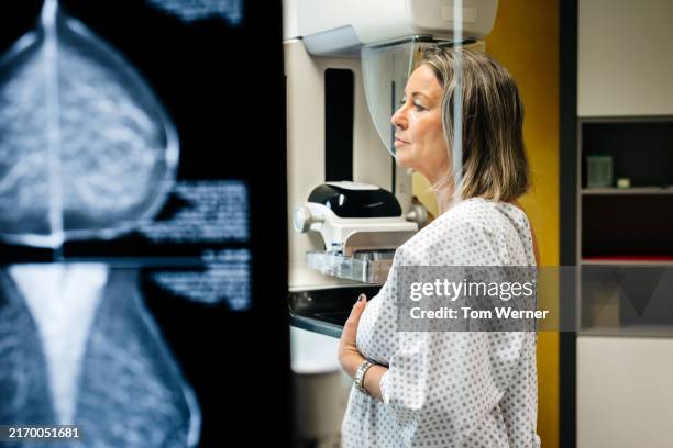 woman undergoing mammogram procedure - mammographie photos et images de collection