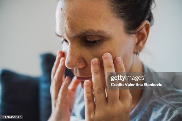 donna contusa che si tocca il viso - gonfio foto e immagini stock