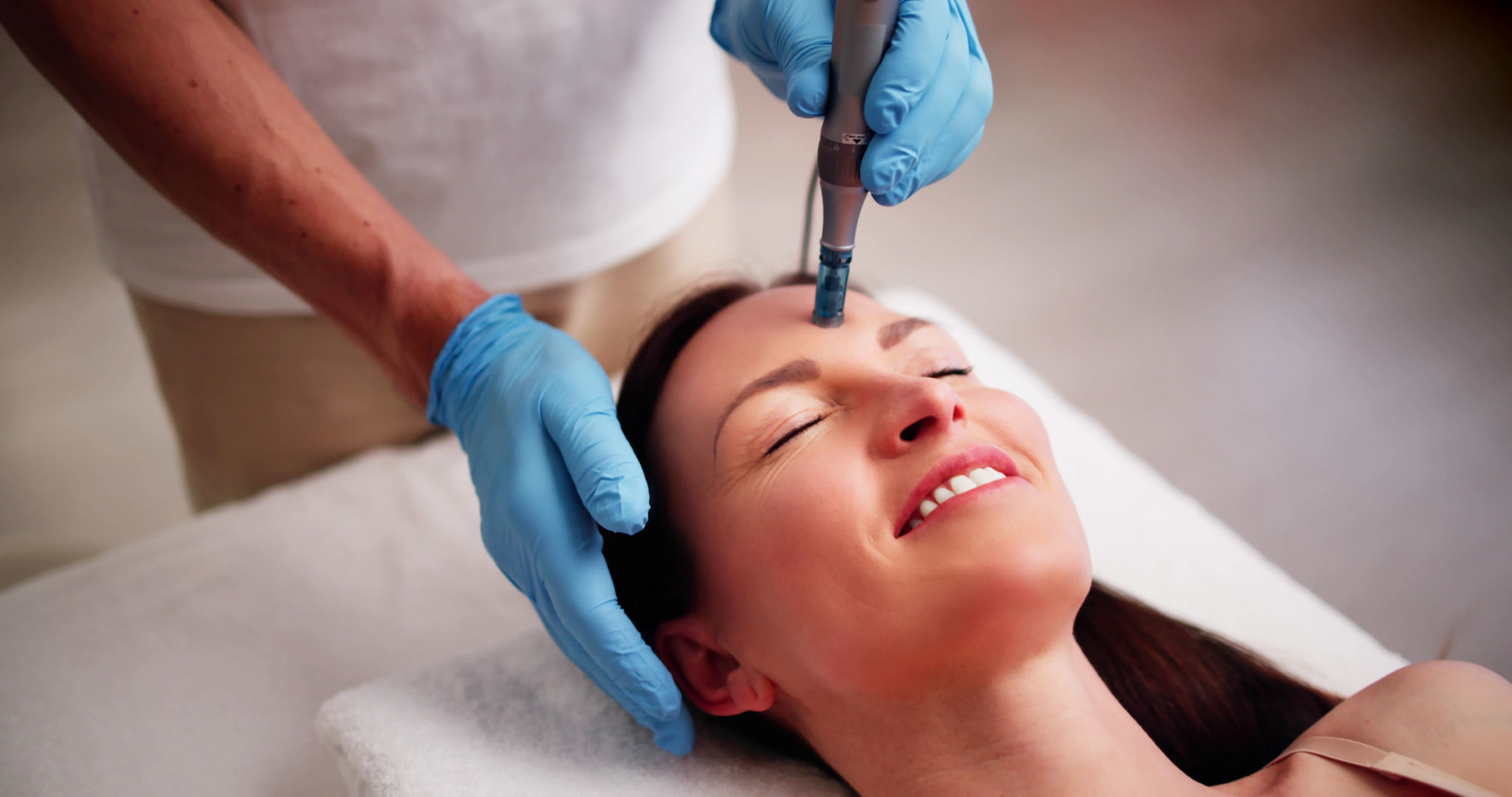 skin needling