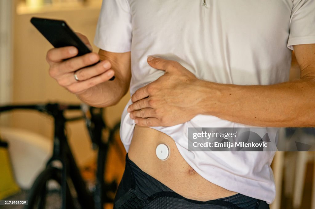 Male athlete, cyclist or triathlete, in cycling clothes is measuring blood glucose level with his mobile phone connected to continuous glucose monitor. He is using medical alert device for blood glucose monitoring during his training or competition.
