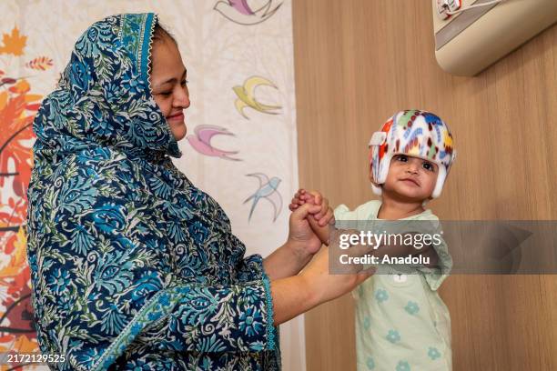 Mother Nazia Parveen takes care of Mirha and Minal, 8-month-old Pakistani twins born conjoined at the head, during their healing process after...