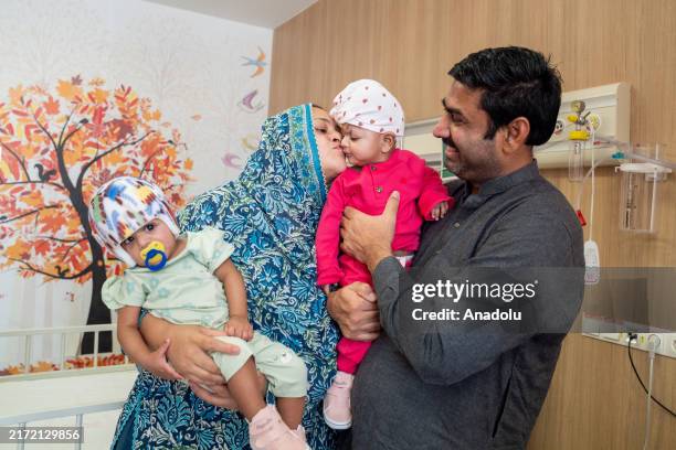 Father Rehan Ali and mother Nazia Parveen take care of Mirha and Minal, 8-month-old Pakistani twins born conjoined at the head, during their healing...